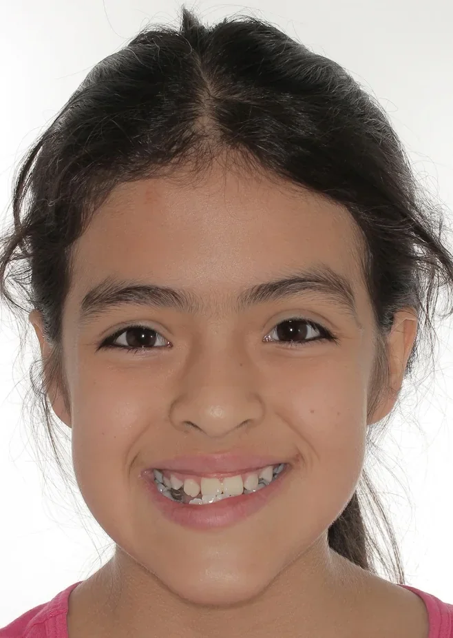 María Isabel a los 11 años, inicio del tratamiento